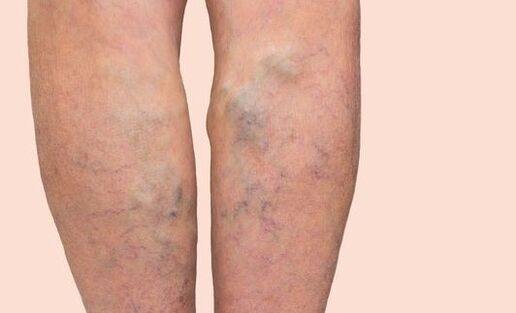 Different veins