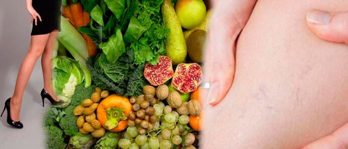 Varicose diet